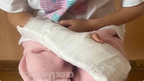 Электросамокатчики сбили ребенка